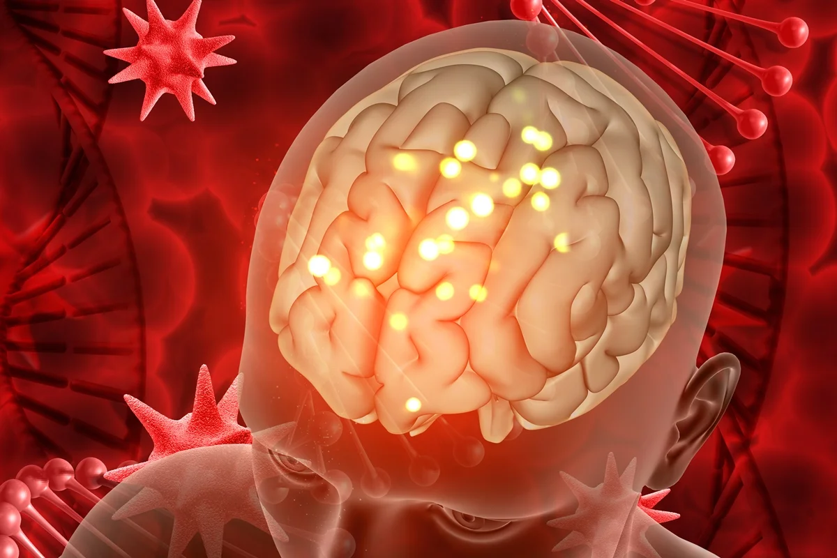 Câncer cria espécie de “ninho” enquanto cresce no cérebro, aponta estudo